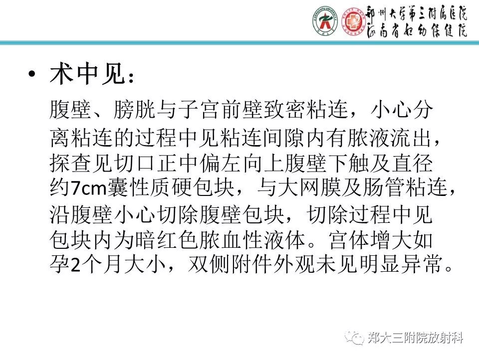 【PPT】腹壁子宫内膜异位症
