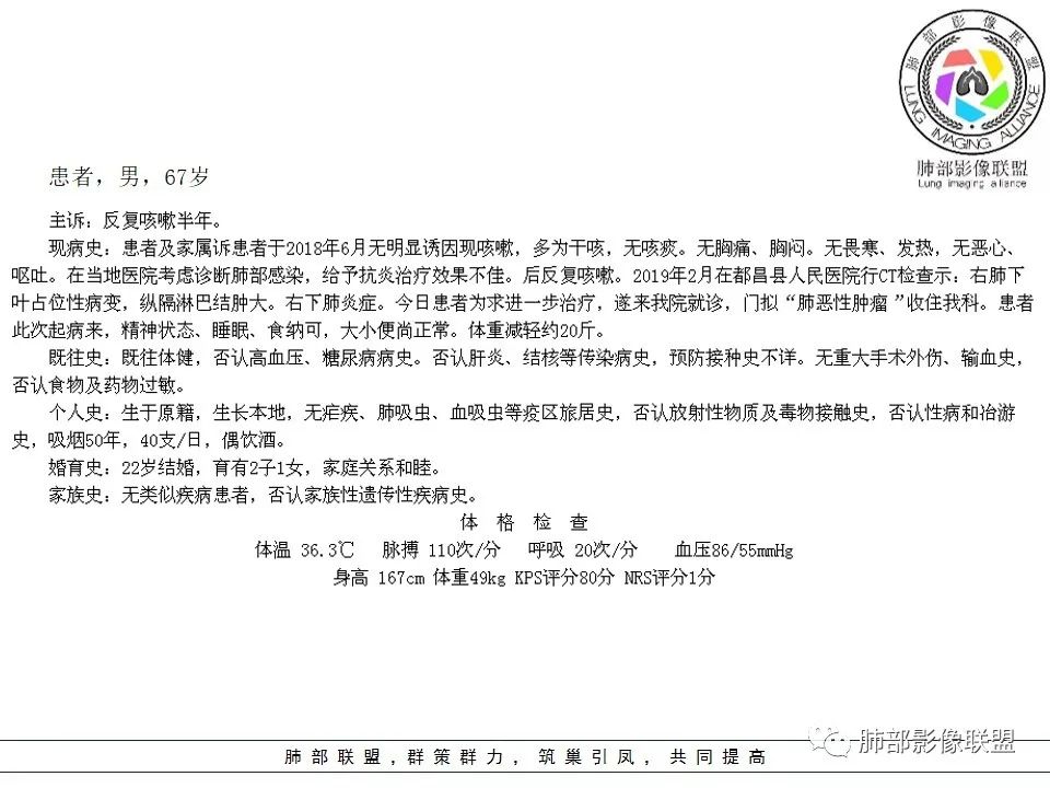 【病例】肺不典型类癌1例CT影像讨论