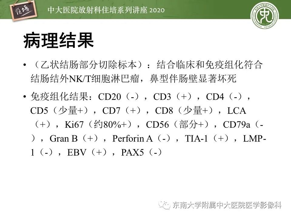 【PPT】腹部淋巴瘤影像诊断及鉴别