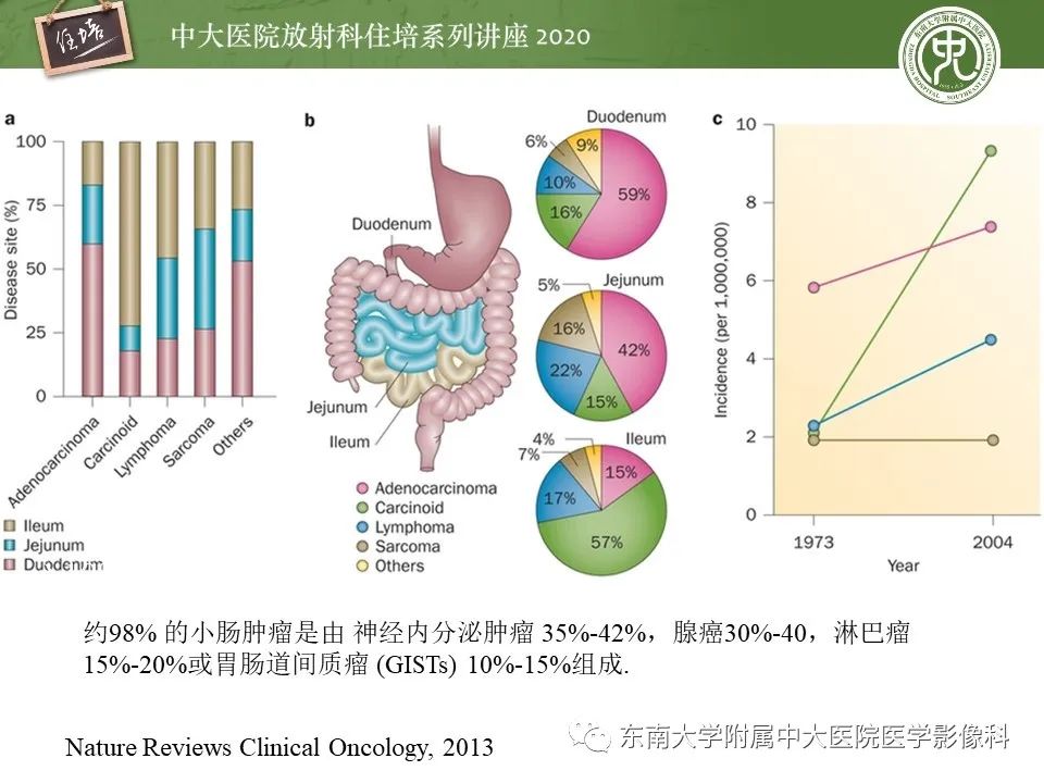 【PPT】腹部淋巴瘤影像诊断及鉴别