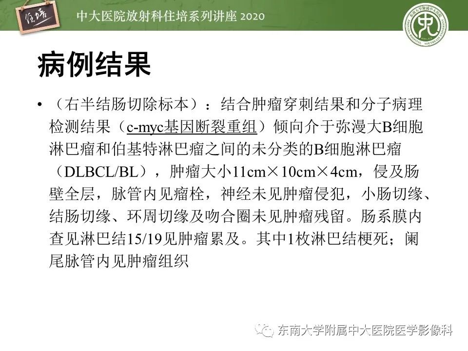【PPT】腹部淋巴瘤影像诊断及鉴别