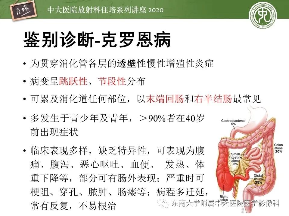 【PPT】腹部淋巴瘤影像诊断及鉴别