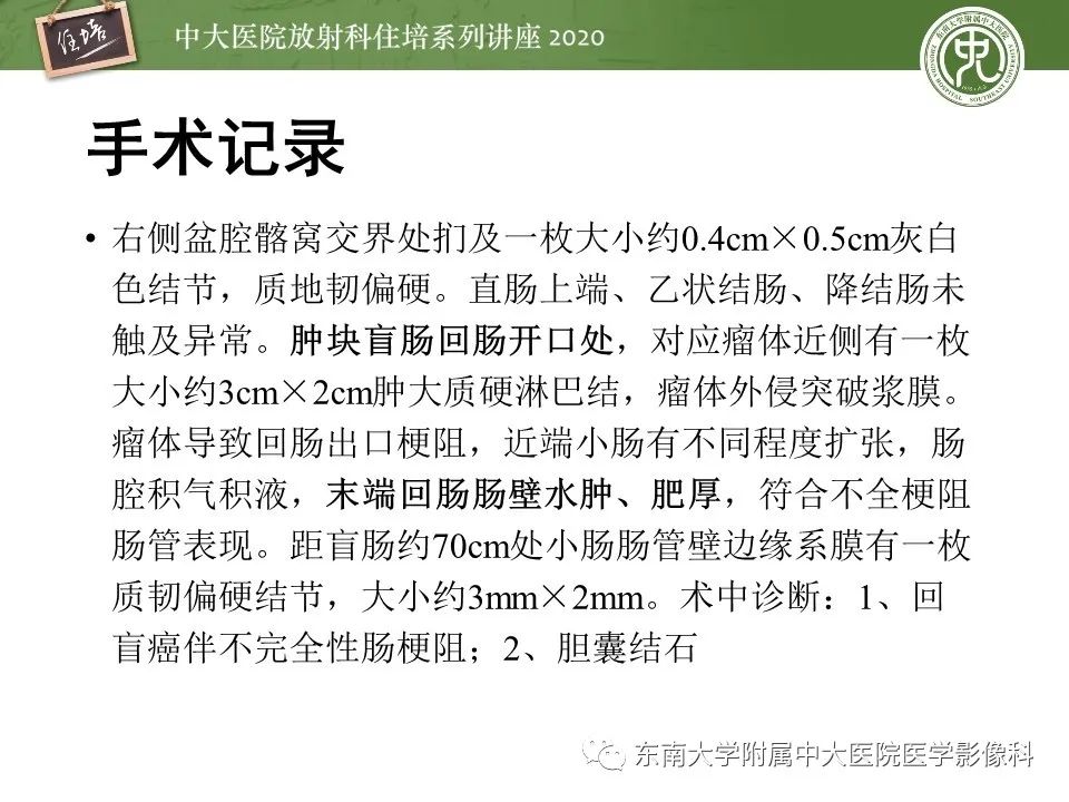 【PPT】腹部淋巴瘤影像诊断及鉴别
