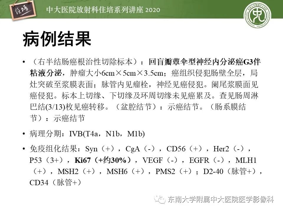 【PPT】腹部淋巴瘤影像诊断及鉴别