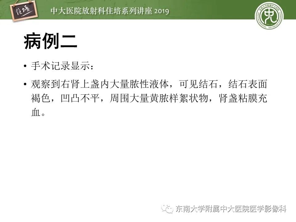 【PPT】肾脏感染性病变的影像学表现