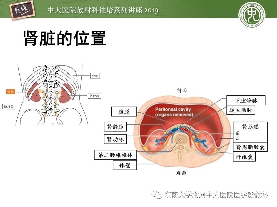【PPT】肾脏感染性病变的影像学表现