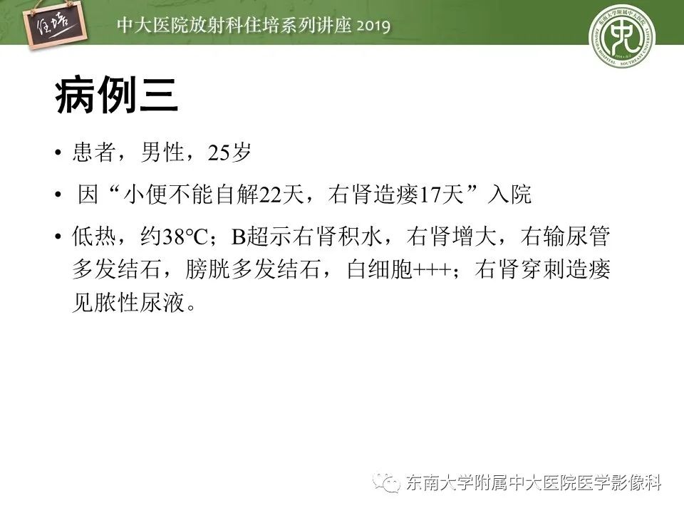 【PPT】肾脏感染性病变的影像学表现