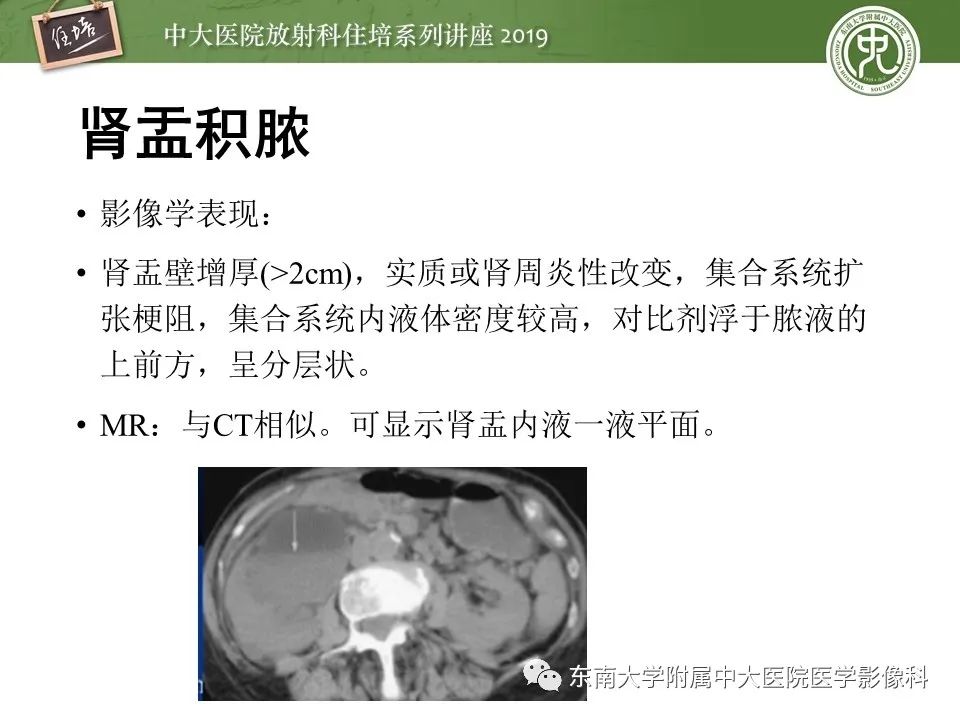 【PPT】肾脏感染性病变的影像学表现