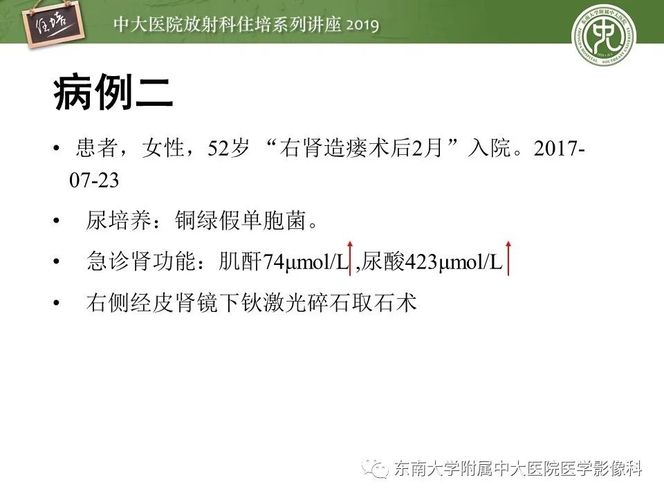 【PPT】肾脏感染性病变的影像学表现