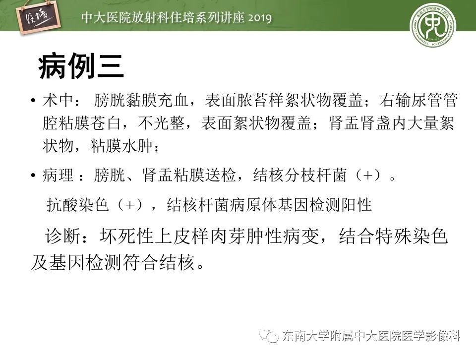【PPT】肾脏感染性病变的影像学表现