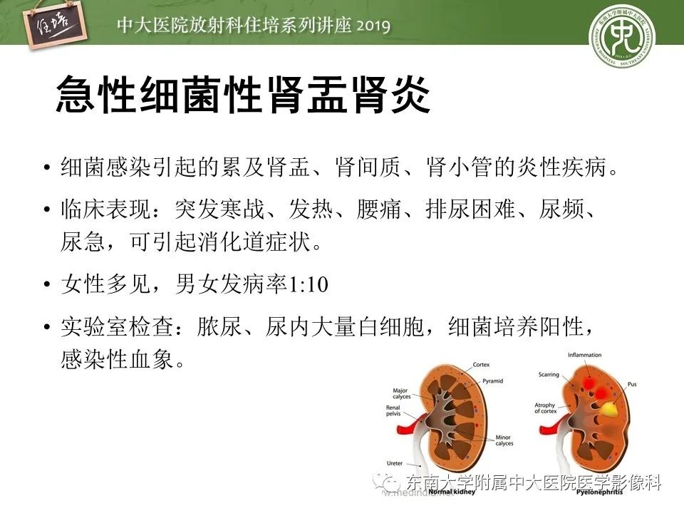 【PPT】肾脏感染性病变的影像学表现