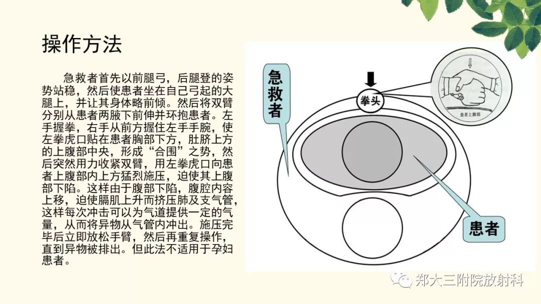 【PPT】支气管异物的CT分析