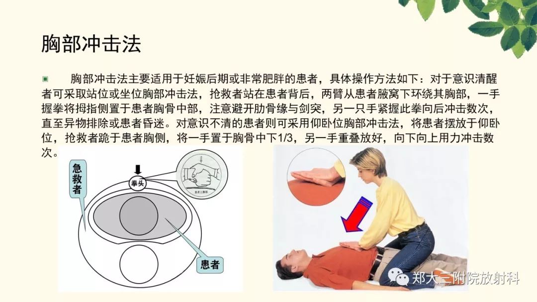 【PPT】支气管异物的CT分析
