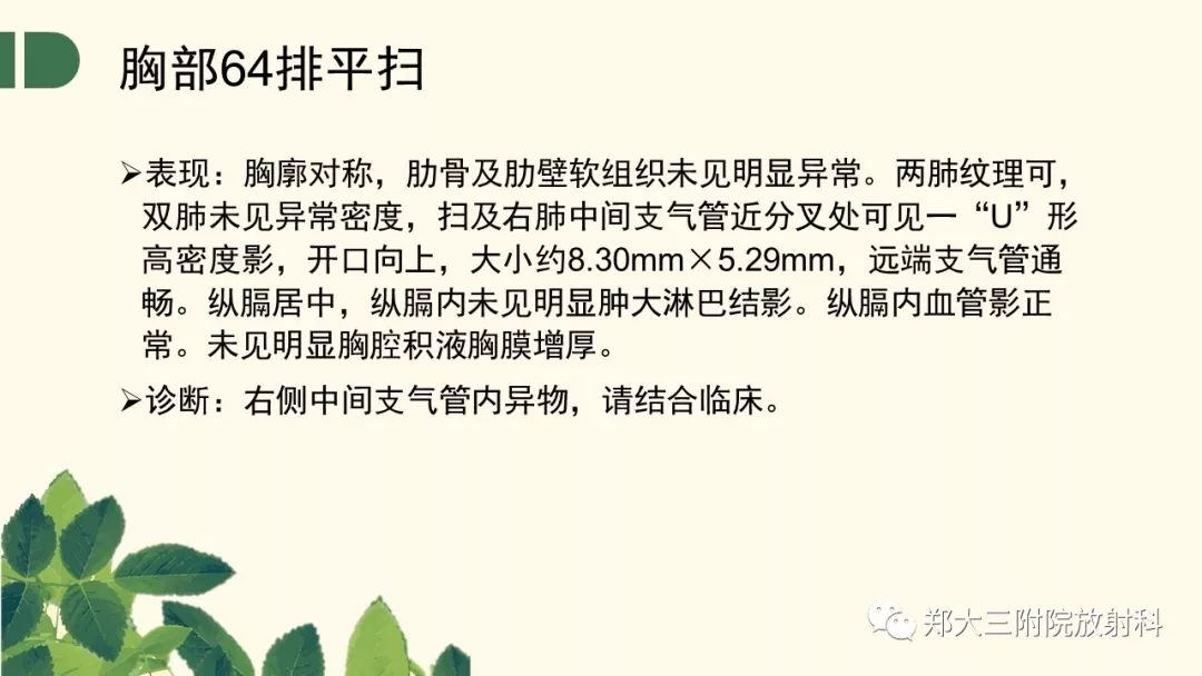 【PPT】支气管异物的CT分析