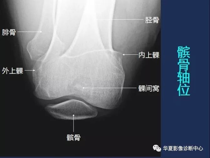X线解剖图谱+系统解剖（骨骼篇）