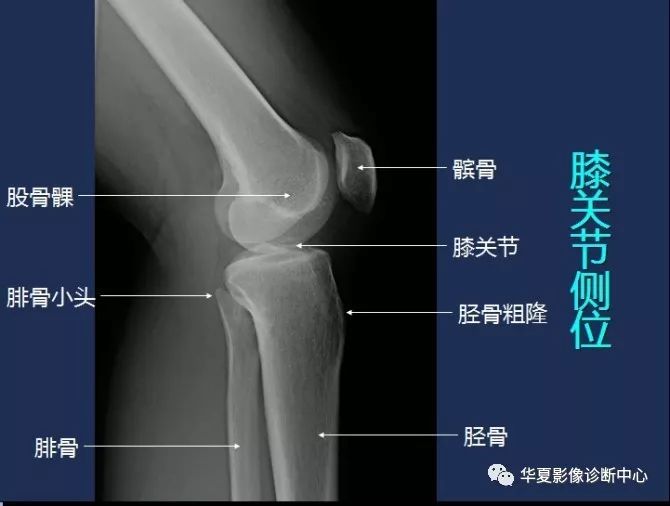 X线解剖图谱+系统解剖（骨骼篇）