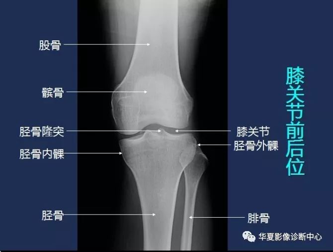 X线解剖图谱+系统解剖（骨骼篇）