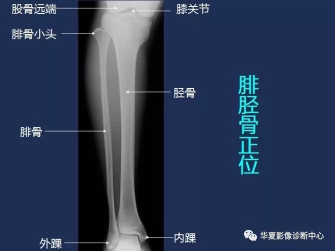 X线解剖图谱+系统解剖（骨骼篇）