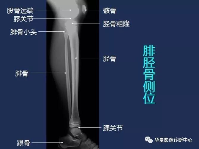 X线解剖图谱+系统解剖（骨骼篇）