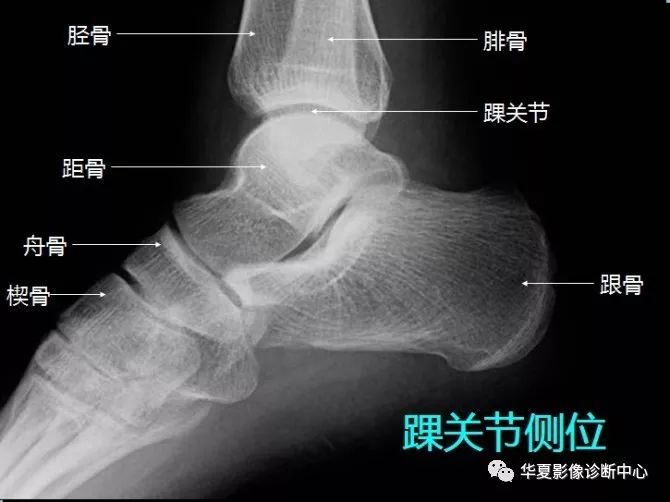 X线解剖图谱+系统解剖（骨骼篇）