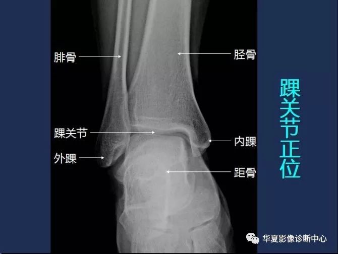 X线解剖图谱+系统解剖（骨骼篇）