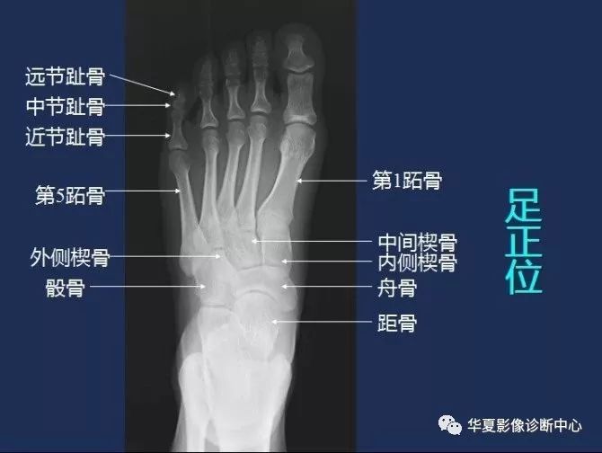 X线解剖图谱+系统解剖（骨骼篇）