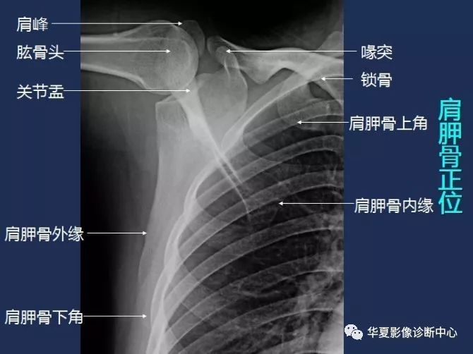 X线解剖图谱+系统解剖（骨骼篇）