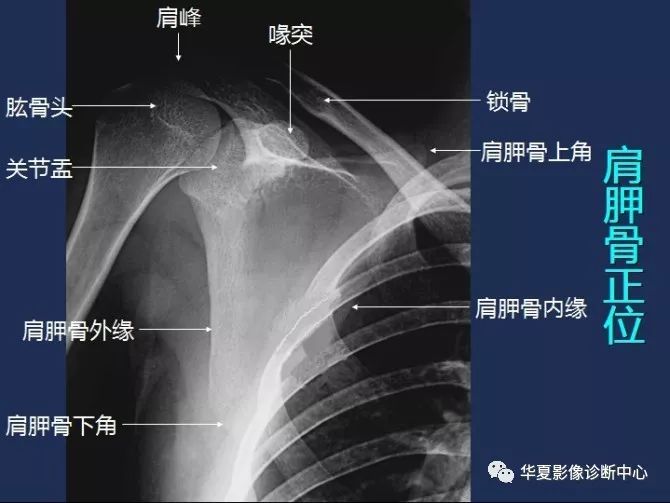 X线解剖图谱+系统解剖（骨骼篇）