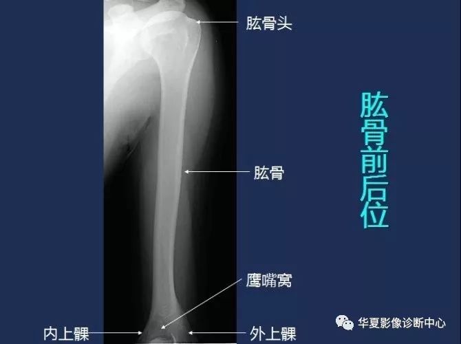 X线解剖图谱+系统解剖（骨骼篇）