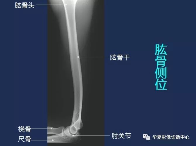 X线解剖图谱+系统解剖（骨骼篇）