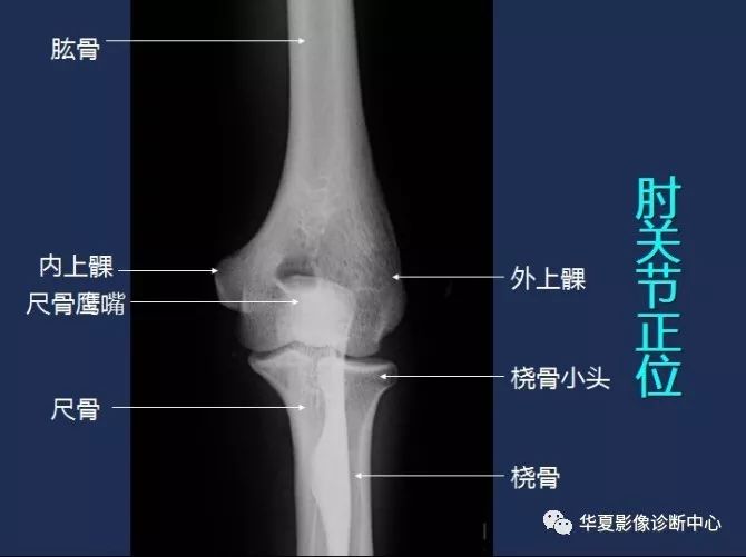 X线解剖图谱+系统解剖（骨骼篇）