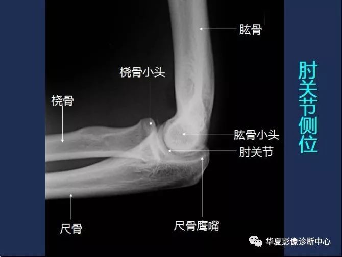 X线解剖图谱+系统解剖（骨骼篇）