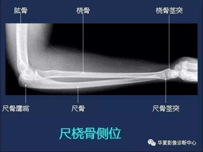 X线解剖图谱+系统解剖（骨骼篇）
