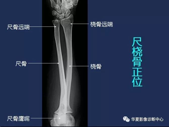 X线解剖图谱+系统解剖（骨骼篇）