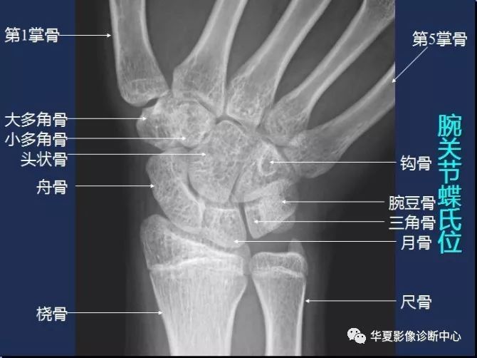 X线解剖图谱+系统解剖（骨骼篇）