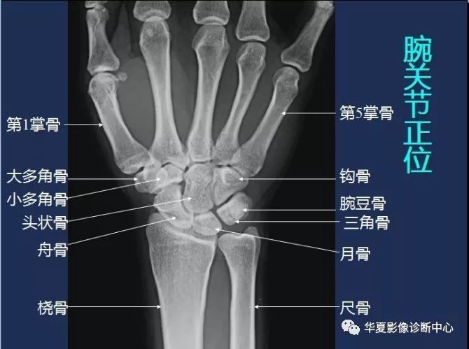 X线解剖图谱+系统解剖（骨骼篇）