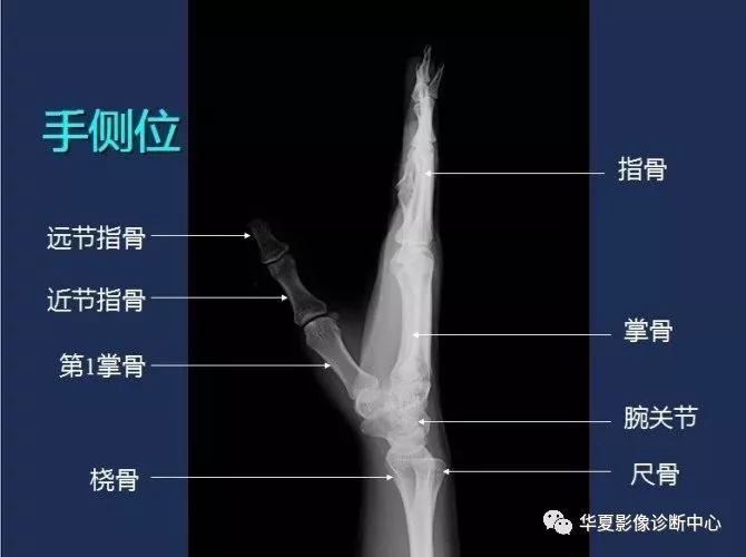 X线解剖图谱+系统解剖（骨骼篇）