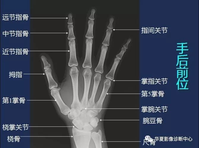 X线解剖图谱+系统解剖（骨骼篇）