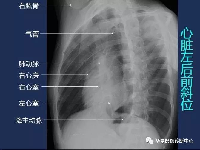 X线解剖图谱+系统解剖（骨骼篇）