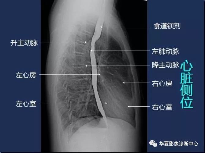 X线解剖图谱+系统解剖（骨骼篇）