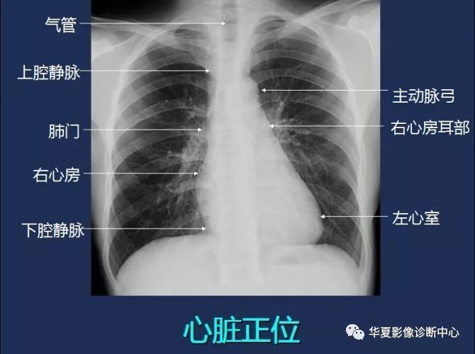 X线解剖图谱+系统解剖（骨骼篇）