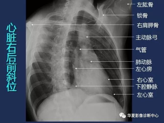 X线解剖图谱+系统解剖（骨骼篇）