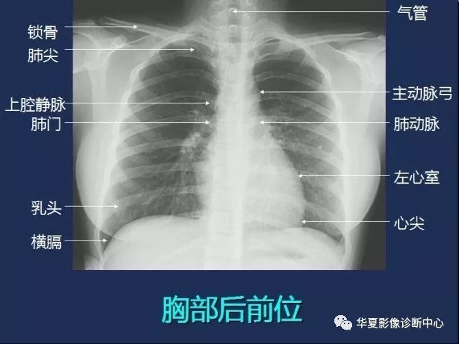 X线解剖图谱+系统解剖（骨骼篇）
