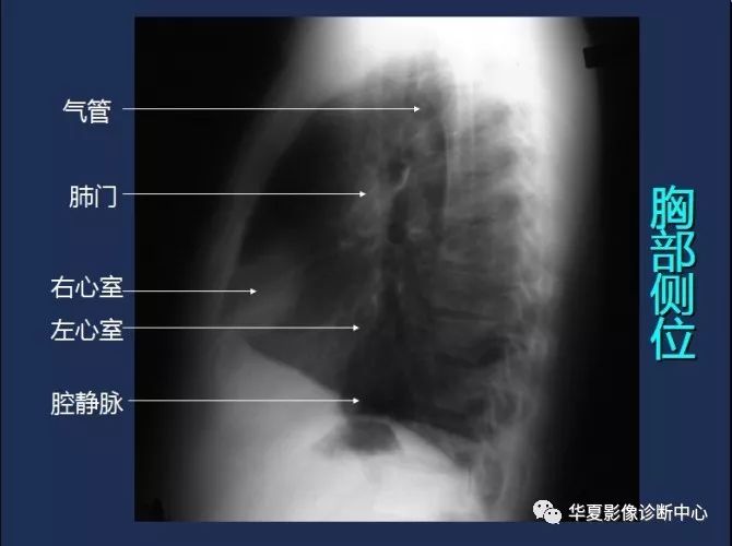 X线解剖图谱+系统解剖（骨骼篇）
