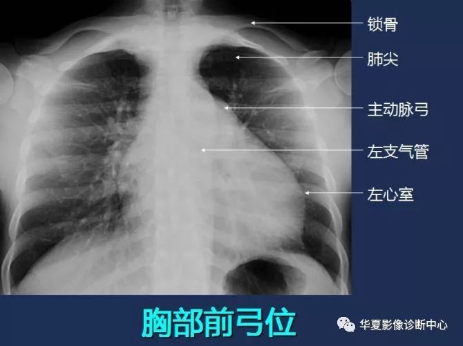 X线解剖图谱+系统解剖（骨骼篇）