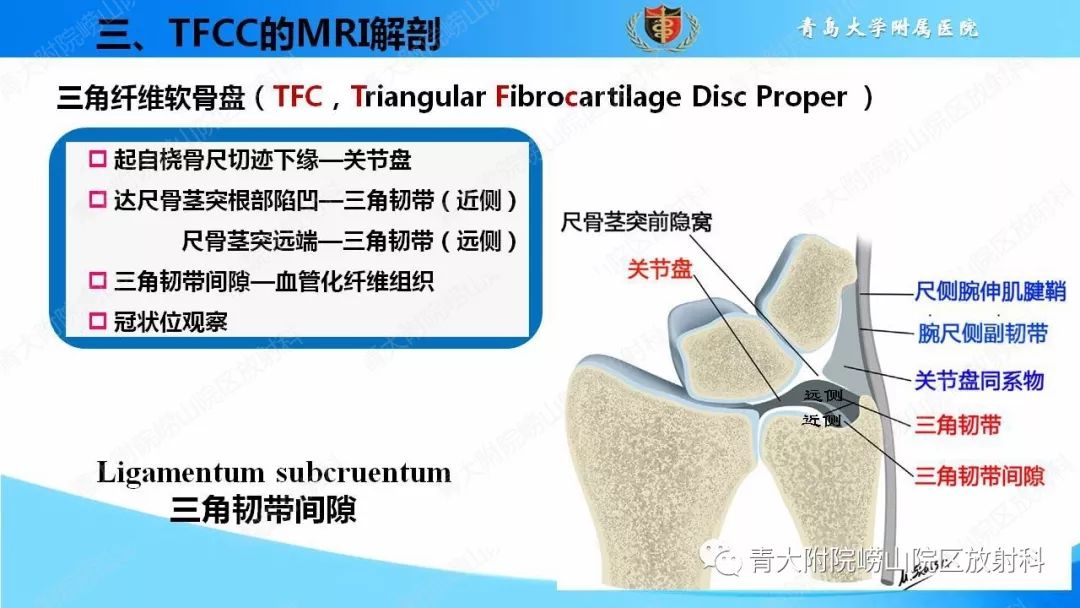 【PPT】TFCC损伤的MRI诊断