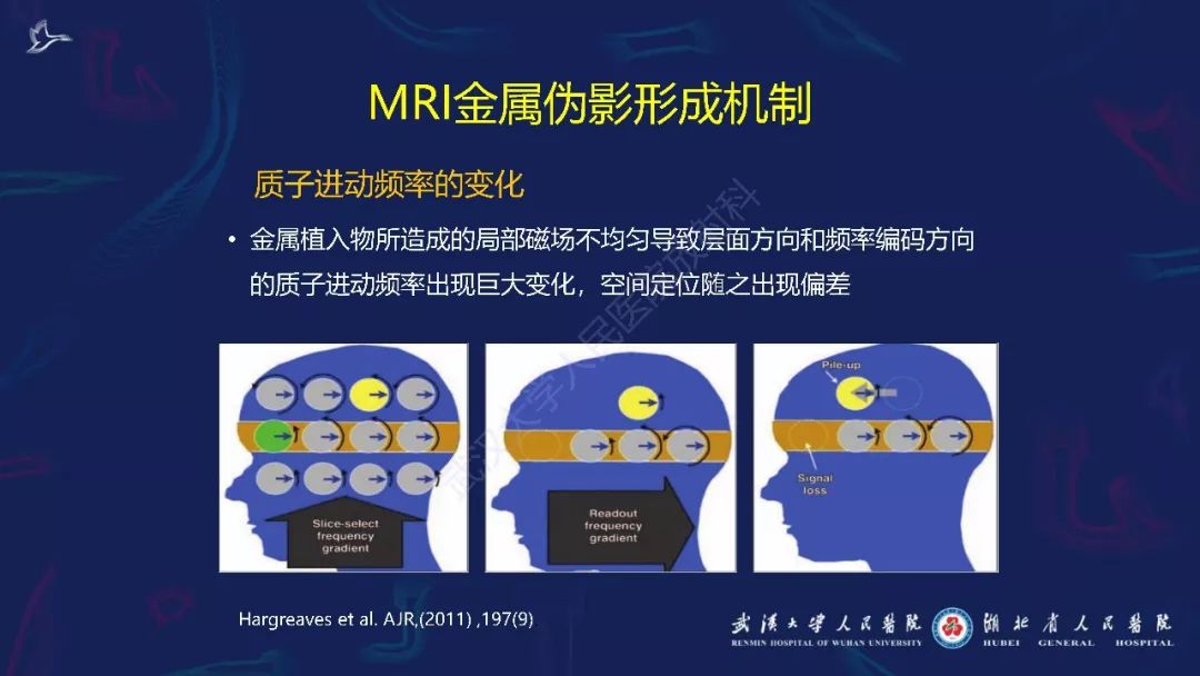 【PPT】肌骨MRI金属伪影抑制技术临床应用