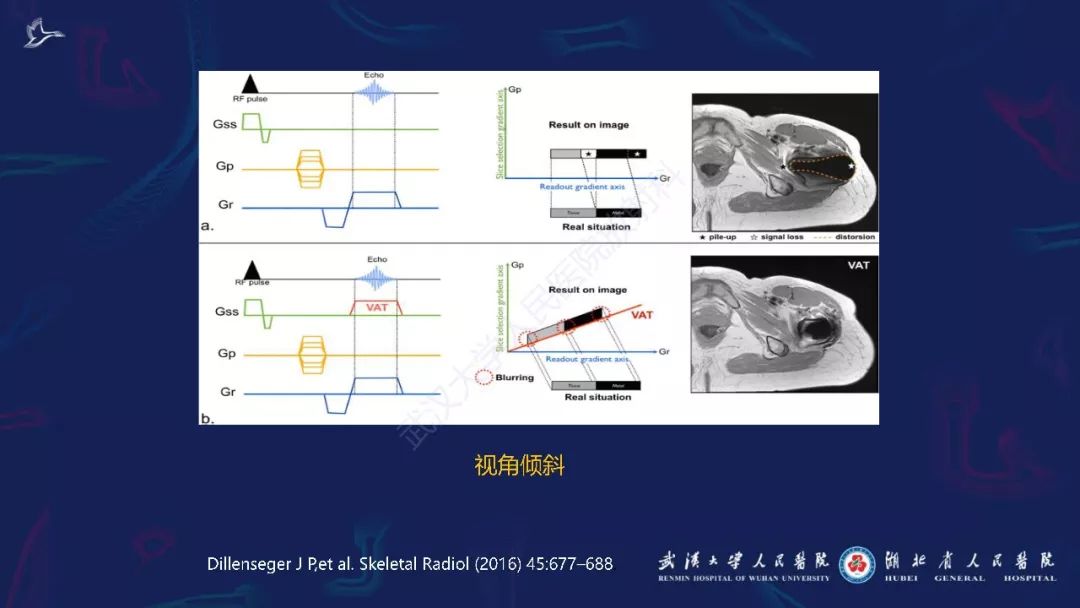 【PPT】肌骨MRI金属伪影抑制技术临床应用