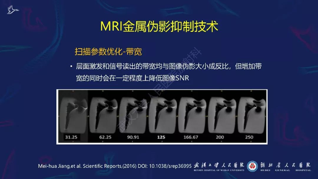 【PPT】肌骨MRI金属伪影抑制技术临床应用