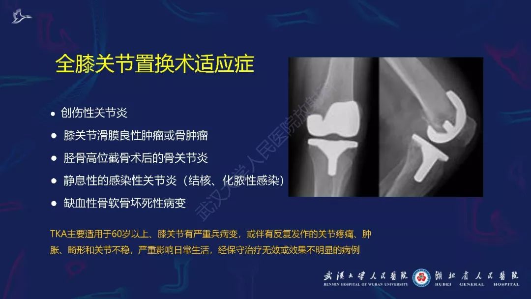【PPT】肌骨MRI金属伪影抑制技术临床应用